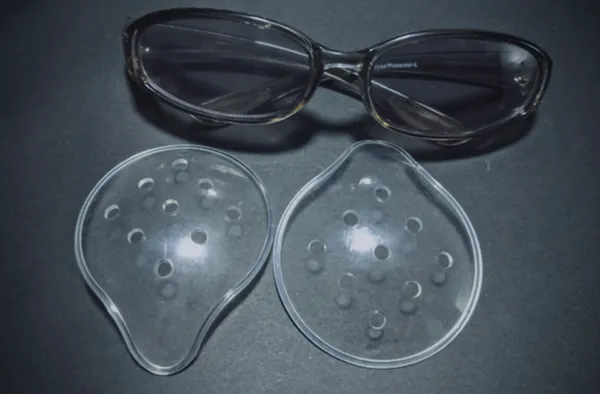 img of ICL手術後、1年経過したときの記録