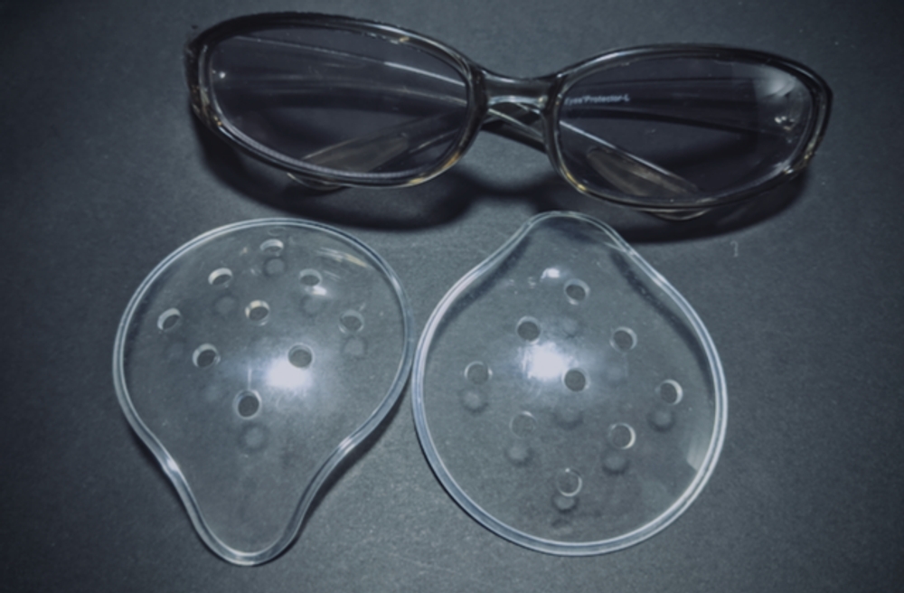 img of ICL手術後、1年経過したときの記録